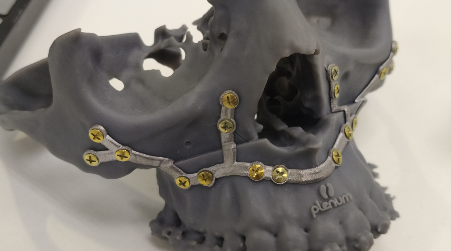 regeneração óssea maxilofacial